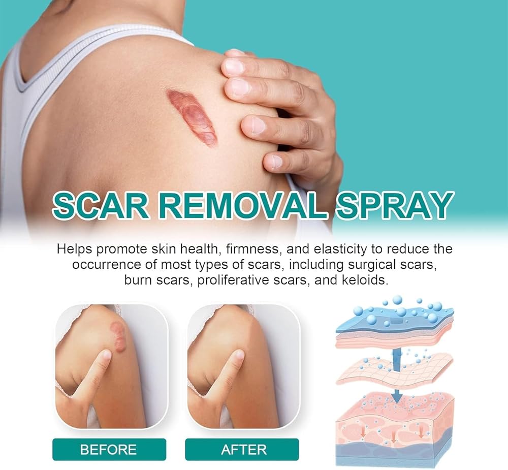 Scar Spray Z360