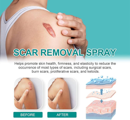 Scar Spray Z360